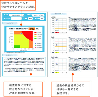 LOX-index検査の結果報告書のイメージ
